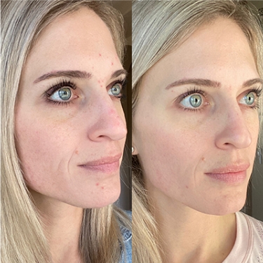 NB-Before-After 375×375 ÔÇô 3