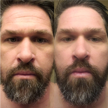 NB-Before-After 375×375 ÔÇô 4